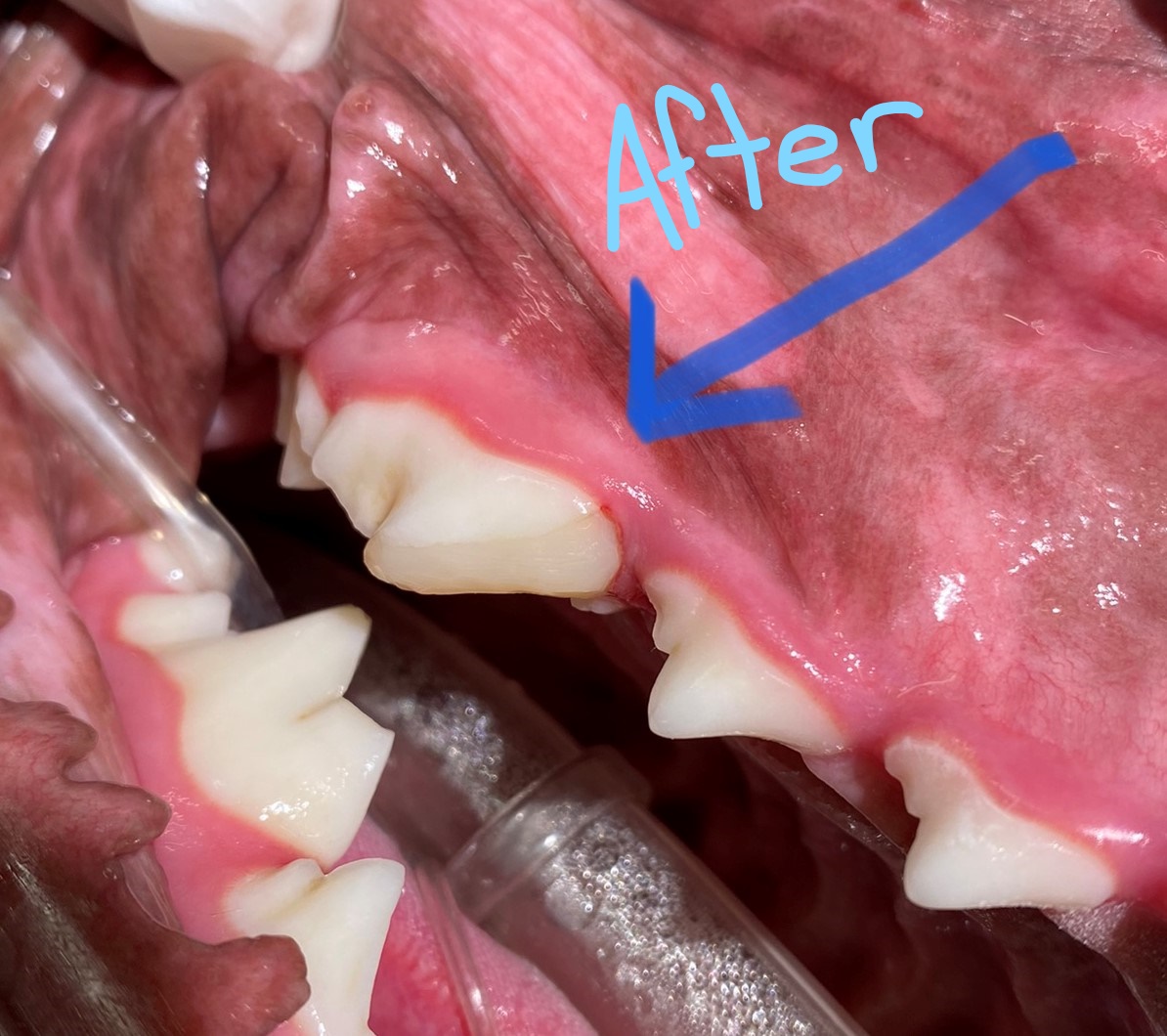 after dental restoration
