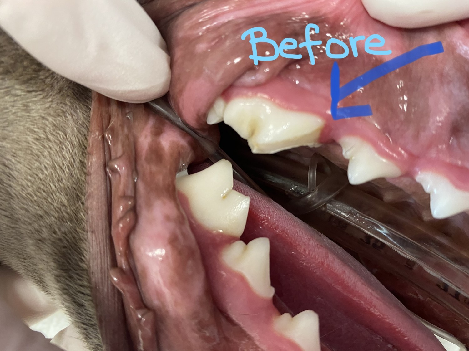 before dental restoration